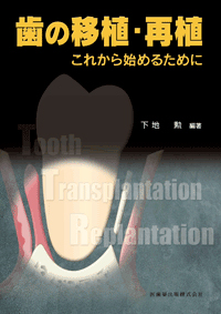 歯の移植・再植